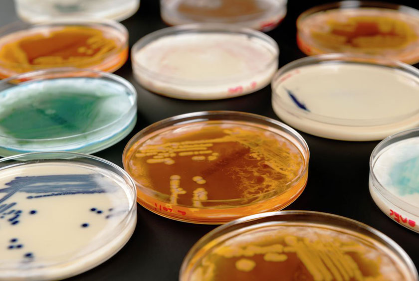 Colonies of bacteria created by bioartist Anna Dumitriu